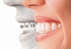 dental-clinic-fogszabalyzas_clearsmile-budapest